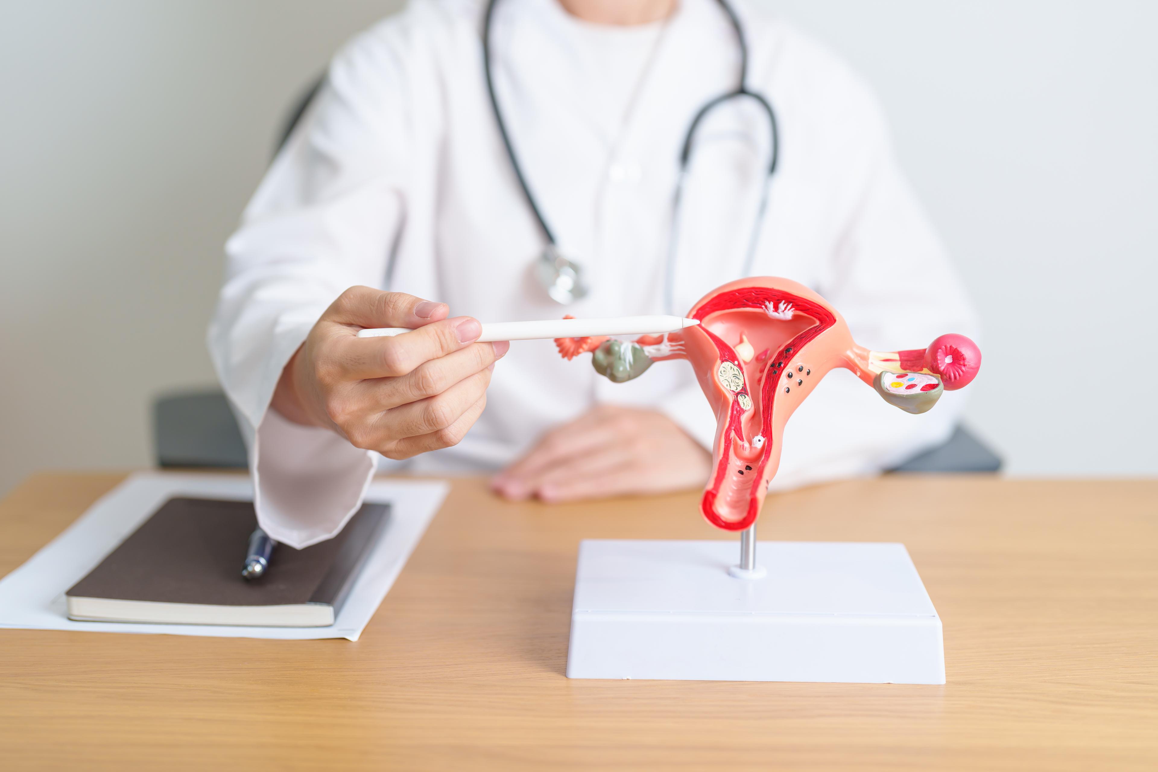 The Impact of PCOS on Egg Quality