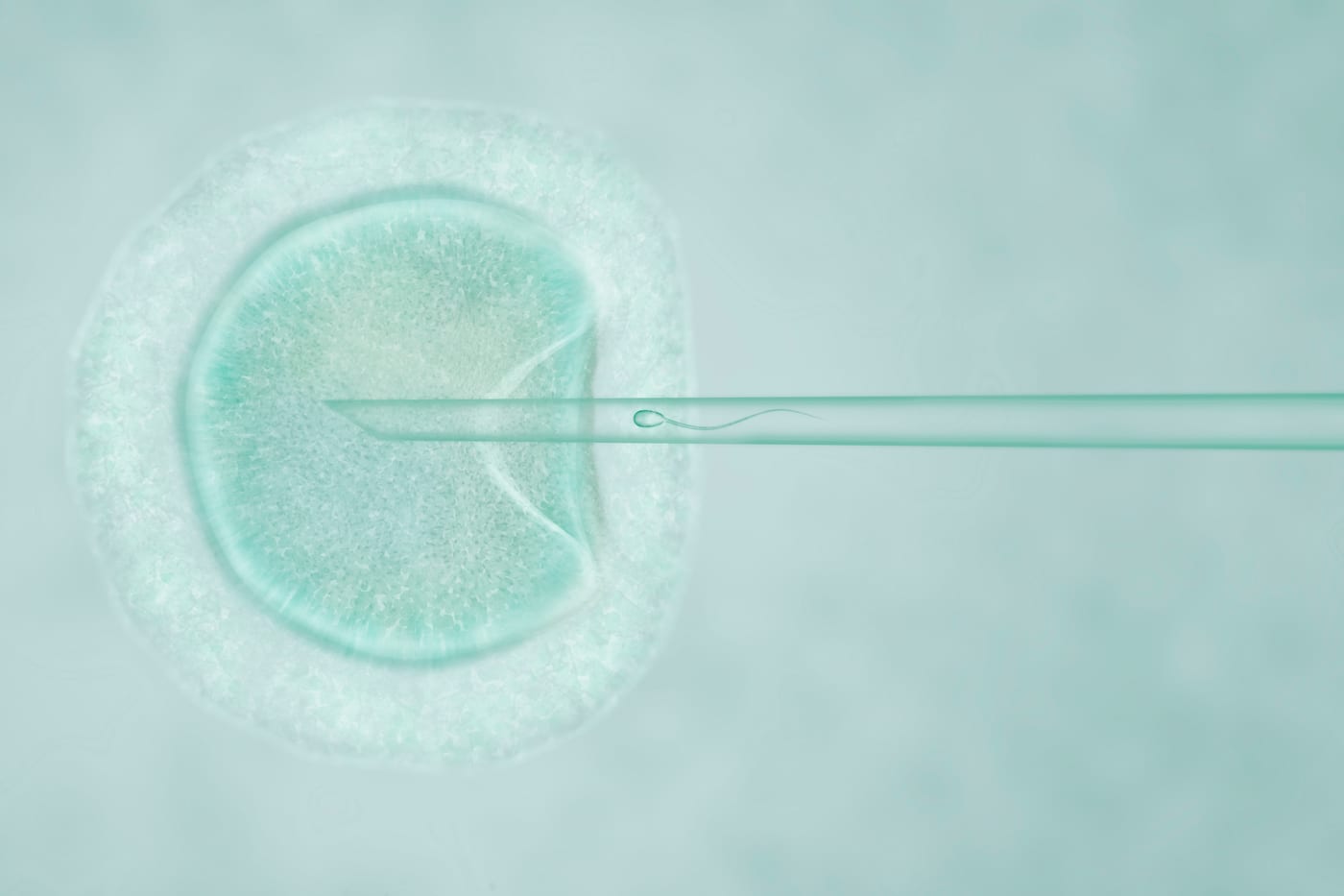 5 Key Steps of ICSI Treatment - Vriksh Fertility | Vriksh Fertility